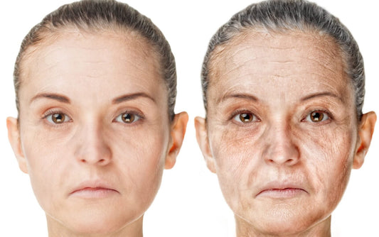 Concerned About Wrinkles? Read This! - OlivinoLife, Inc.