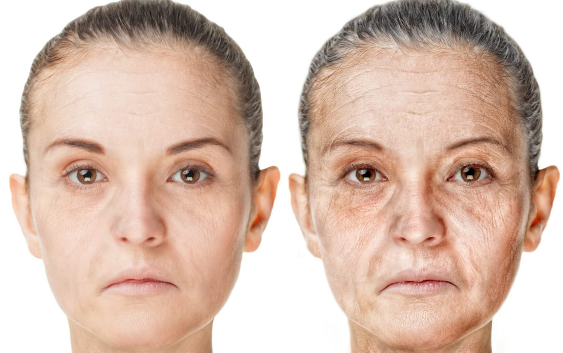 Concerned About Wrinkles? Read This! - OlivinoLife, Inc.